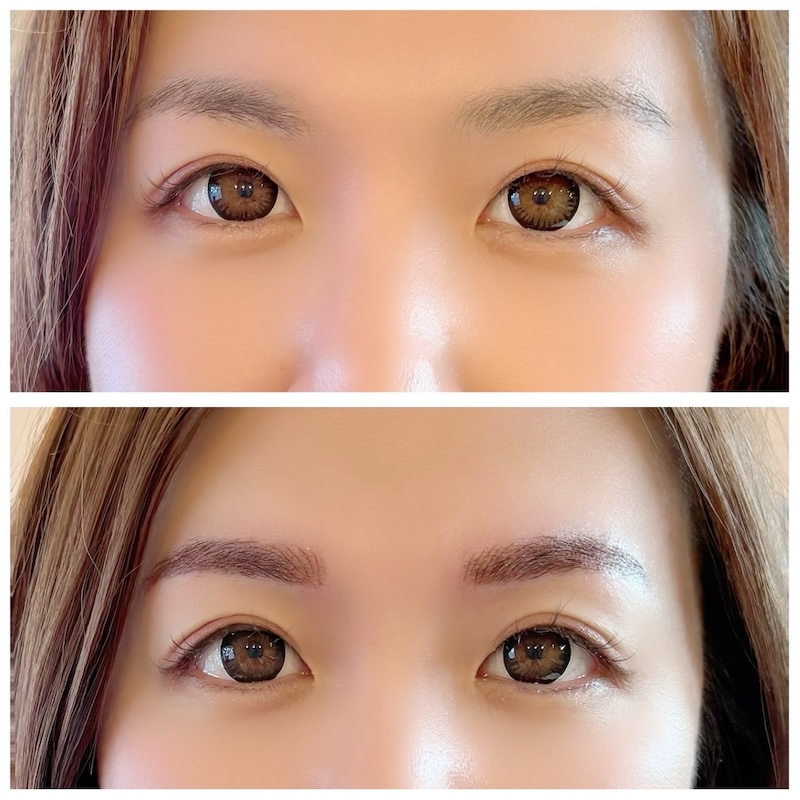 before&after001