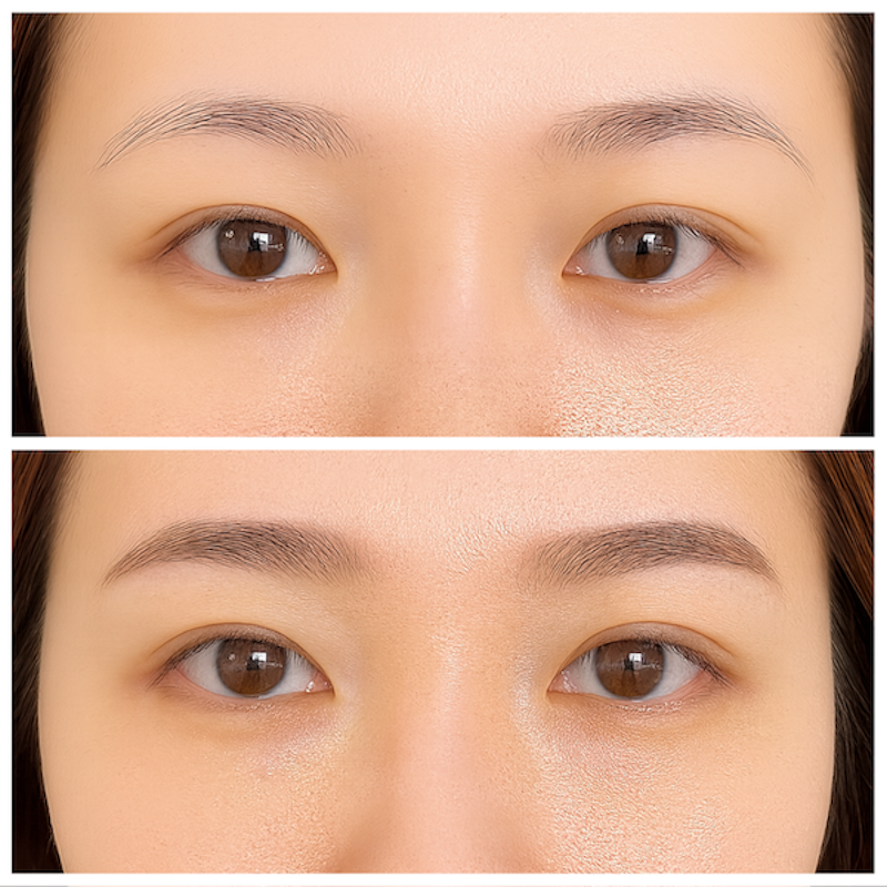 before&after002