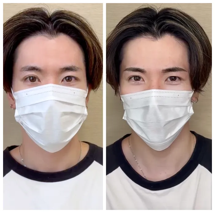 beforeafter006