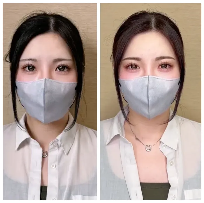 beforeafter007