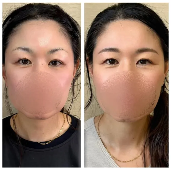 beforeafter008