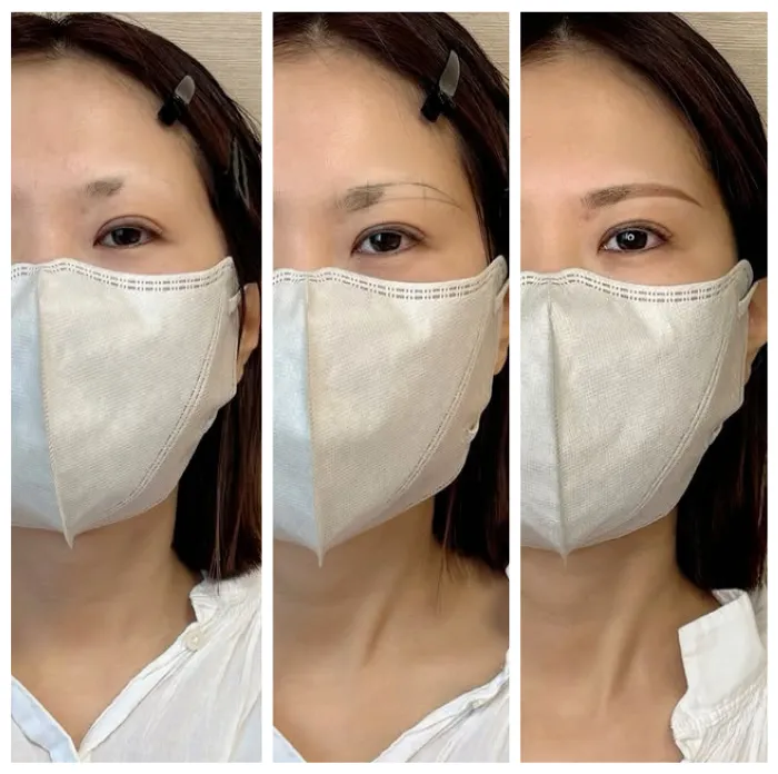 beforeafter009