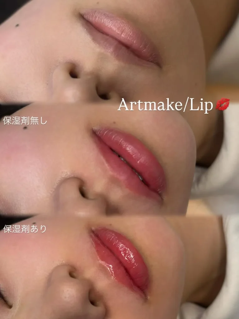 リップ症例2
